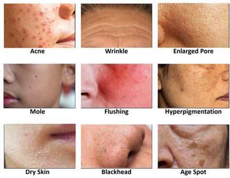 Dry Skin Condition