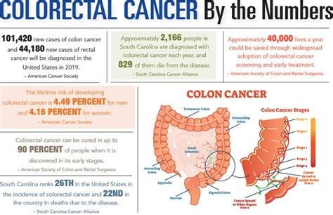 Facts About Colorectal Cancer Upstate Physicians