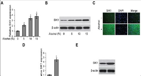 Sik Is Increased In Alcohol Treated Microglial Cells And Brain