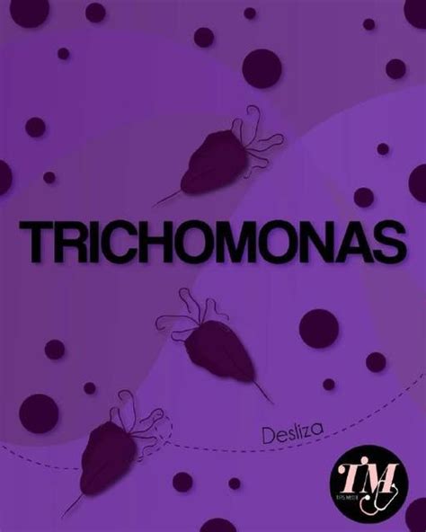 Trichomonas Tips Medic Udocz