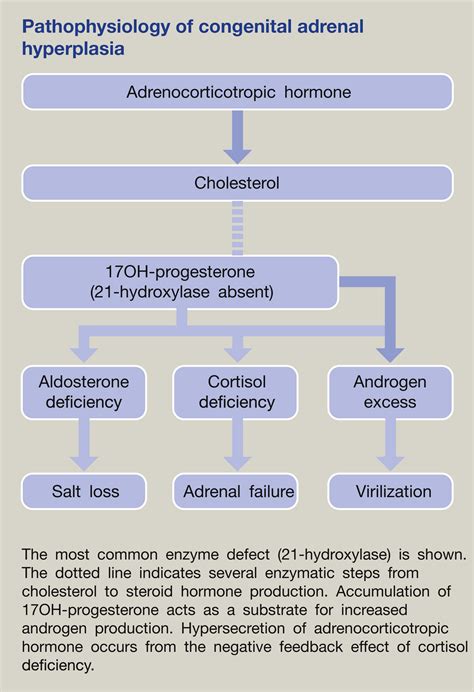 Congenital Adrenal Hyperplasia Medicine