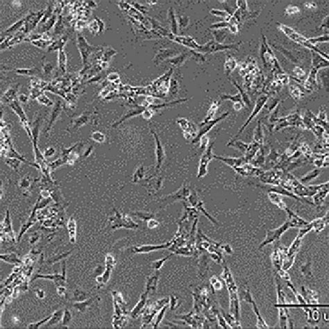 Phase Contrast Microscopy Showing That Sertoli Cells Exhibit A