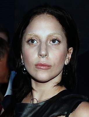 Lady Gaga Plastic Surgery Before And After Photos Celeblens