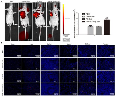 Frontiers Mir 371b 5p Engineered Exosomes Enhances Tumor Inhibitory