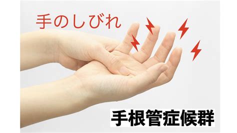 手の痺れ（指の痺れ）の原因となる手根管症候群とは。特徴的な症状とセルフチェック法 その他不調 陽だまり鍼灸整骨院