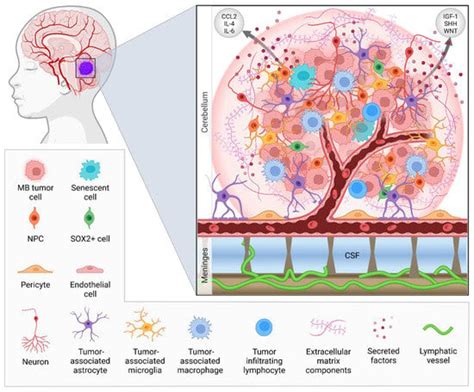 Cancers Free Full Text The Tumor Microenvironment Of