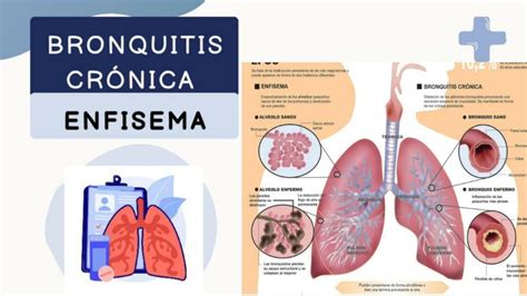 Bronquitis Crónica Y Enfisema Jesus Colmenares Udocz