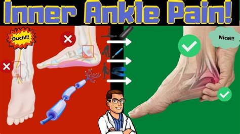 Inside Of The Ankle Pain Tarsal Tunnel Syndrome Treatment Symptoms