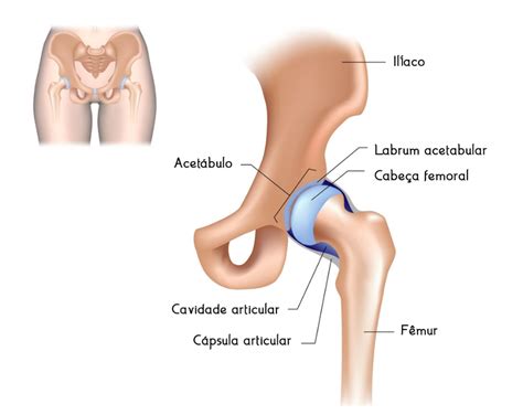 Displasia Do Desenvolvimento Do Quadril Ddq Entenda Tudo Sanarmed