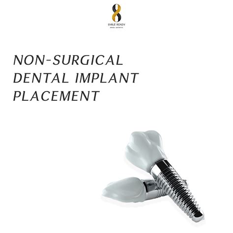 Non Surgical Dental Implant Smile Ready Bali