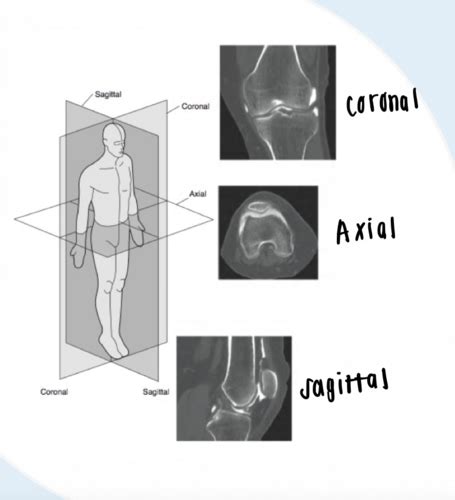 Advanced Imaging Flashcards Quizlet