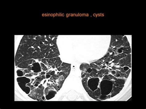 28 Dr Ahmed Esawy Imaging Oral Board Of Chest Imaging Variety Part