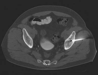 MSK: Radiology 3: Imaging in MSK Radiology Flashcards | Quizlet