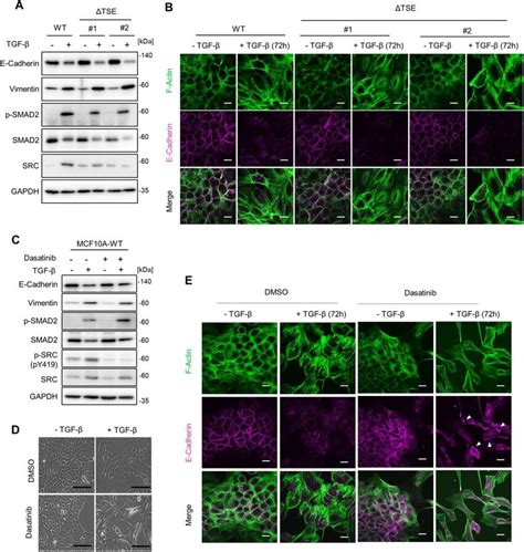 The effect of TSE mutation or SRC inhibition on TGF β induced gene