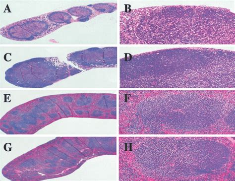 Decreased follicle and germinal center formation in lymph nodes in ...