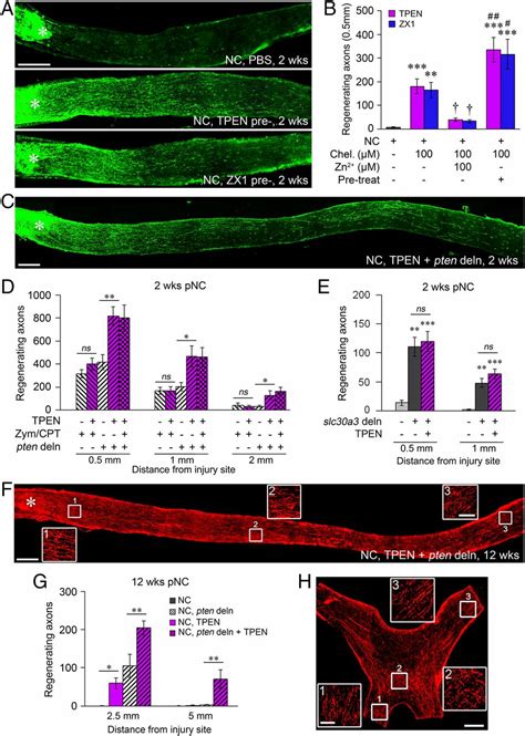 Mobile Zinc Increases Rapidly In The Retina After Optic Nerve Injury