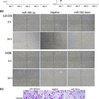 MiR 195 Inhibited Cell Proliferation Cell Migration And Invasion In