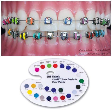 Braces Color Selector Real Teeth