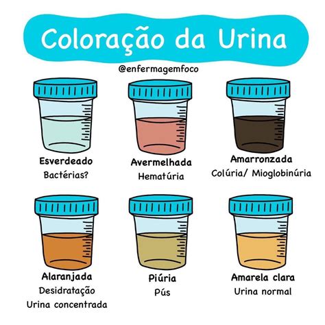 Enfermagem Em Foco On Instagram A Cor Da Urina Pode Ser Alterada