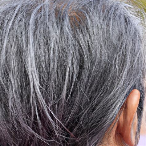 What Causes Hair to Gray? Exploring Genetics, Stress, Nutrition ...