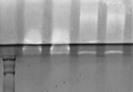 The Zymogram Demonstrating Proteolytic Activity Of The Endopeptidases