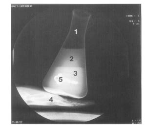 radiology densities diagram quizlet