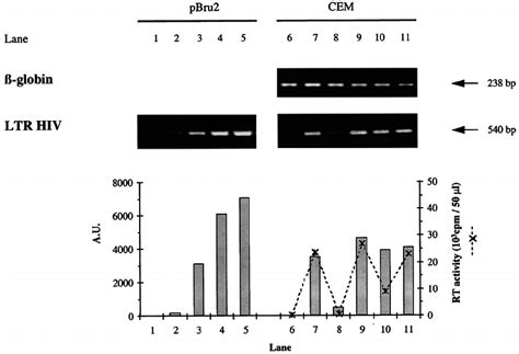 Estimation Of Hiv Proviral Dna In Cem Cells Infected With The Hiv 1 Lai