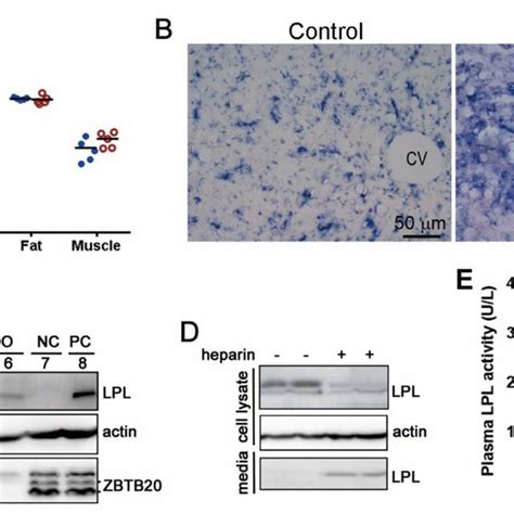 Liver ZBTB20 Deficiency Increases LPL Expression In Hepatocytes And LPL