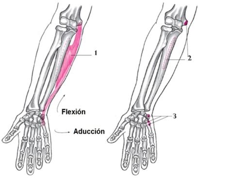 Tendinitis Del Cubital Anterior