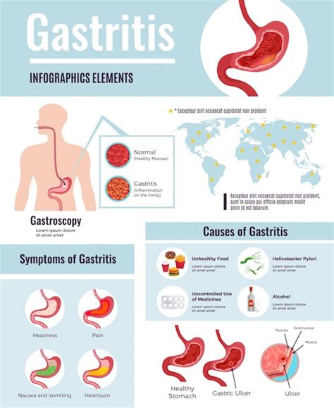 Stomach Ulcers Signs And Symptoms