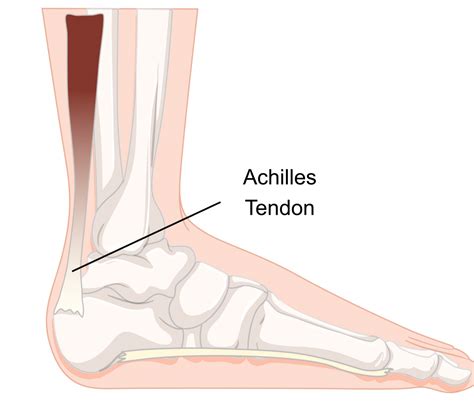 Achilles Tendon Anatomy Diagram