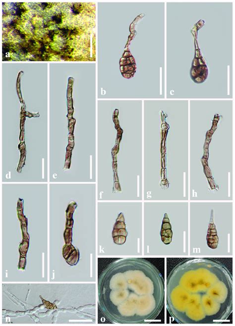 Alternaria Pseudoinfectoria Mflu 21 0311 Holotype A Colonies On