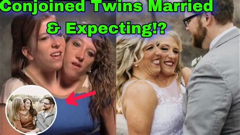 Brittany & Abby Conjoined Twins Major Update! Married & What Else? i 2024