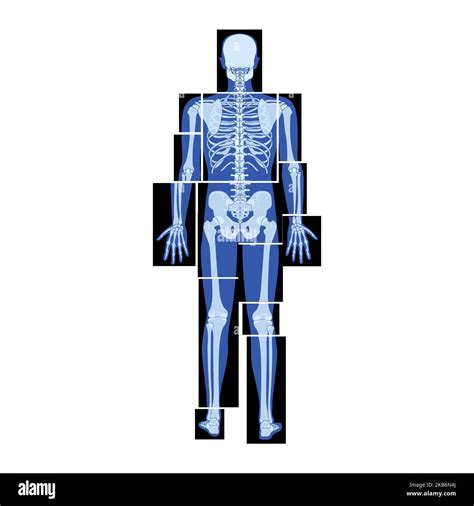 Conjunto De Esqueleto De Rayos X Partes Del Cuerpo Humano Manos