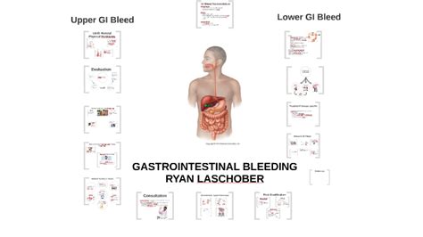 GASTROINTESTINAL BLEEDING by on Prezi