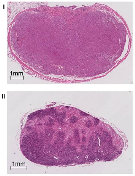 Histology Of Xenograft Tumor And Lymph Node Metastasis In Toto Hande