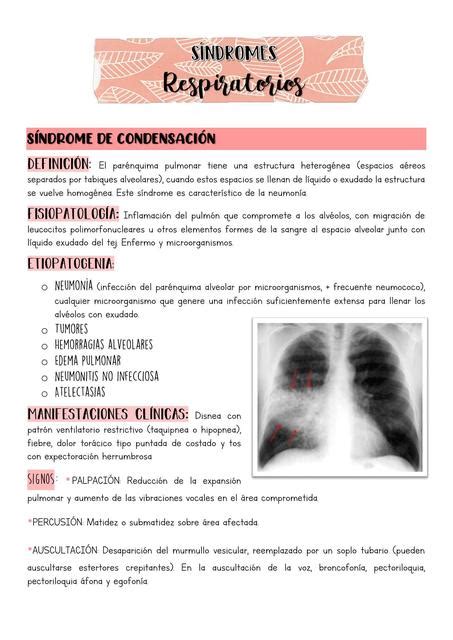 Síndromes respiratorios Fátima Ojeda uDocz