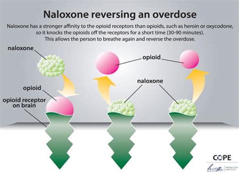 How Naloxone Works North Carolina Health News