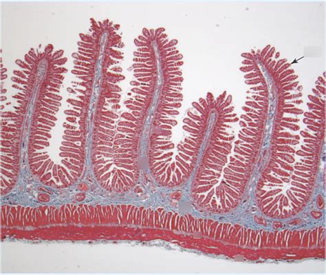 Week 9: Jejunum Histology Diagram | Quizlet