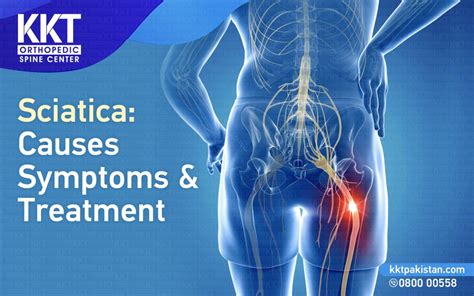 Sciatica: Treatment Symptoms and Causes