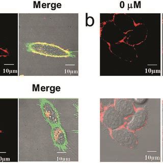 A Colocalization Experiments Of Anrp M And Nr M On The Cell