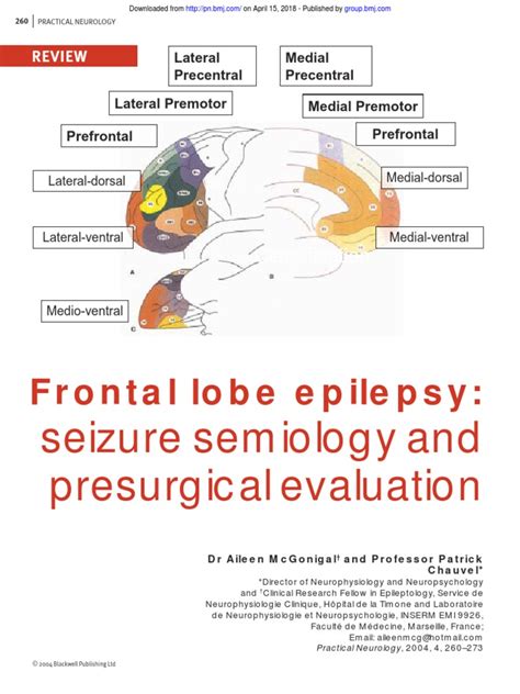 Frontal Lobe Epilepsy | Epilepsy | Electroencephalography