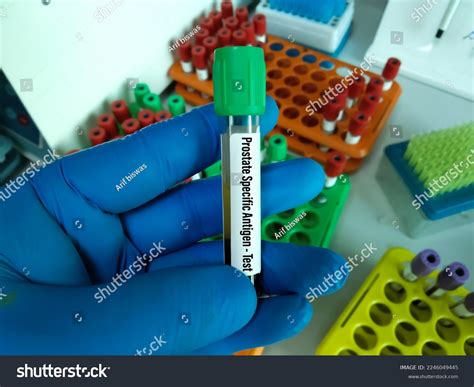 Blood Sample Psa Prostate Specific Antigen Stock Photo 2246049445