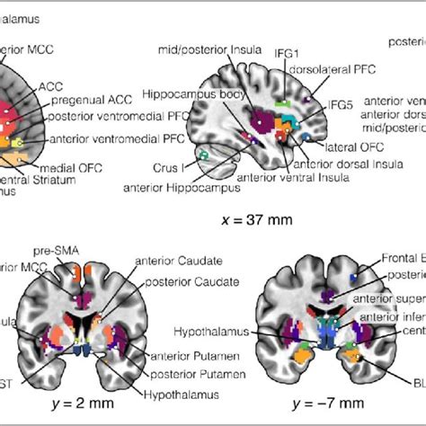 Regions Of Interest ACC Anterior Cingulate Cortex BL BM Amygdala