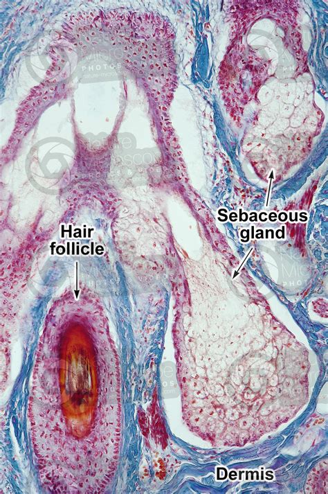 Man Sebaceous Gland Vertical Section X Sebaceous Gland