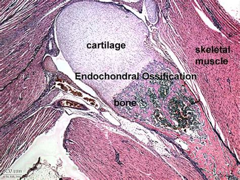 Musculoskeletal System Bone Development Embryology