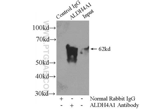 Aldh A Rabbit Anti Human Mouse Rat Polyclonal Proteintech L