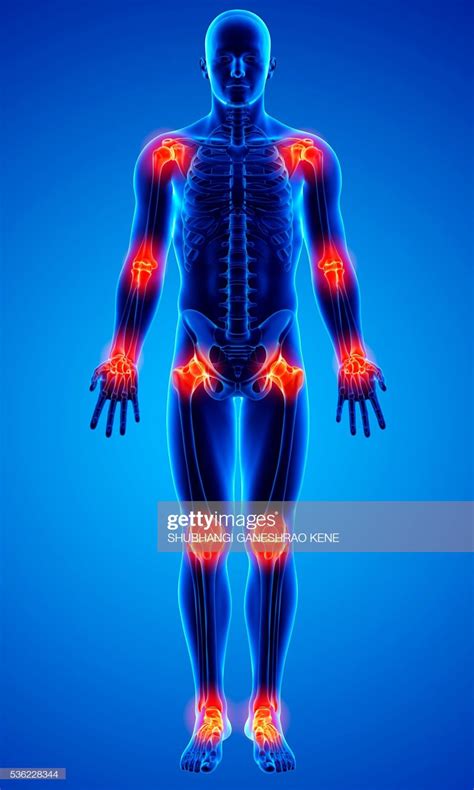 Bursitis Treatment Shoulder Bursitis Knee Bursitis Hip Bursitis