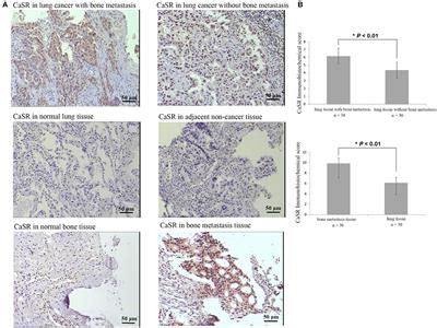 Frontiers Casr Induces Osteoclast Differentiation And Promotes Bone