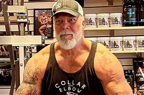 Wwe Legend Kevin Nash Shares Cancer Diagnosis And Scar After Face